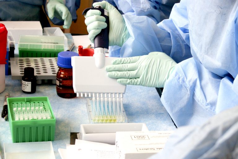 Especialista explicó por qué el Covid-19 sería una enfermedad vascular y no respiratoria