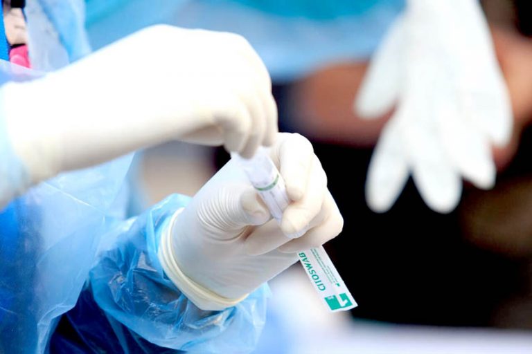 Informan sobre segundo caso de Variante Delta