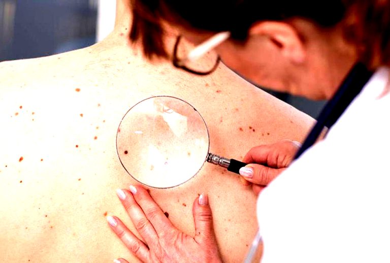 Recomiendan uso de protector solar todo el año para evitar cáncer a la piel