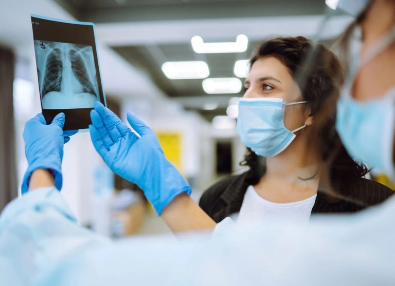 Región del Maule registró 115 casos confirmados de TBC durante el 2021