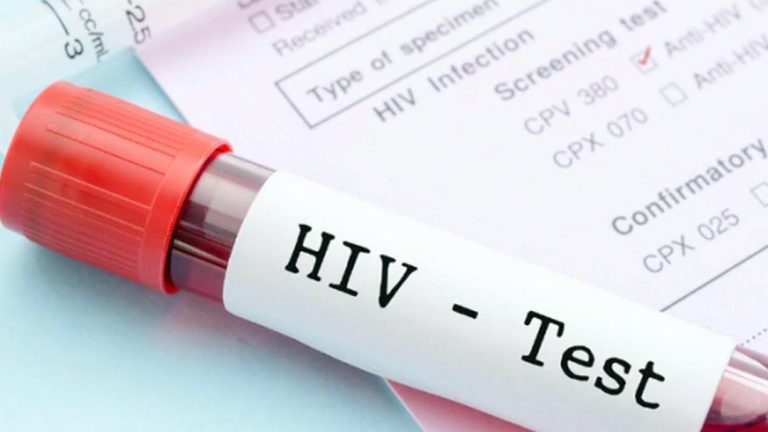 SSM llama a conducta sexual responsable para prevenir riesgo de contagio del VIH