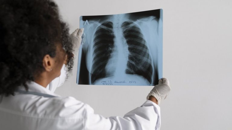 Número de fallecidos por cáncer de pulmón aumentó en un 10% en la Región del Maule